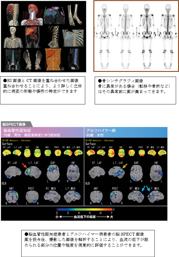 SPECT-CT装置結果　画像